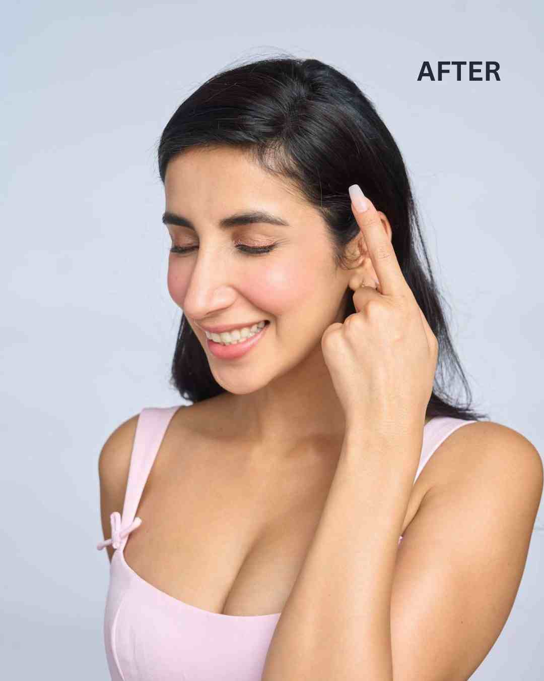 Front Hair Thinning Cover Up Patch - Image 3