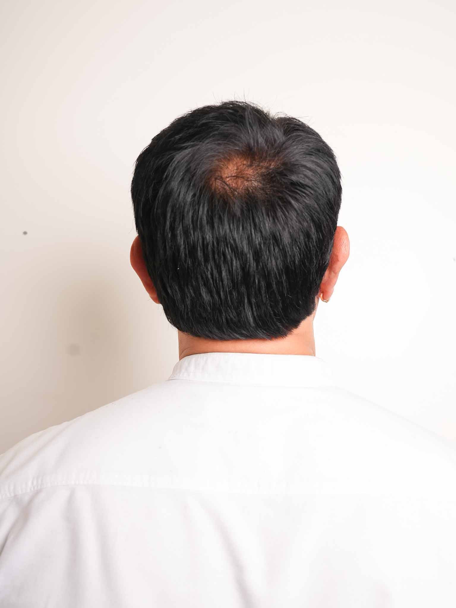 Men Hair Toupée | Pre Cut - Silk Base Most Natural Looking - Image 3